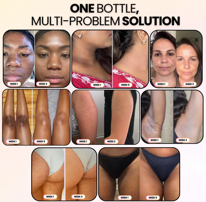 Exfoliating Kojic Acid + Turmeric Spray